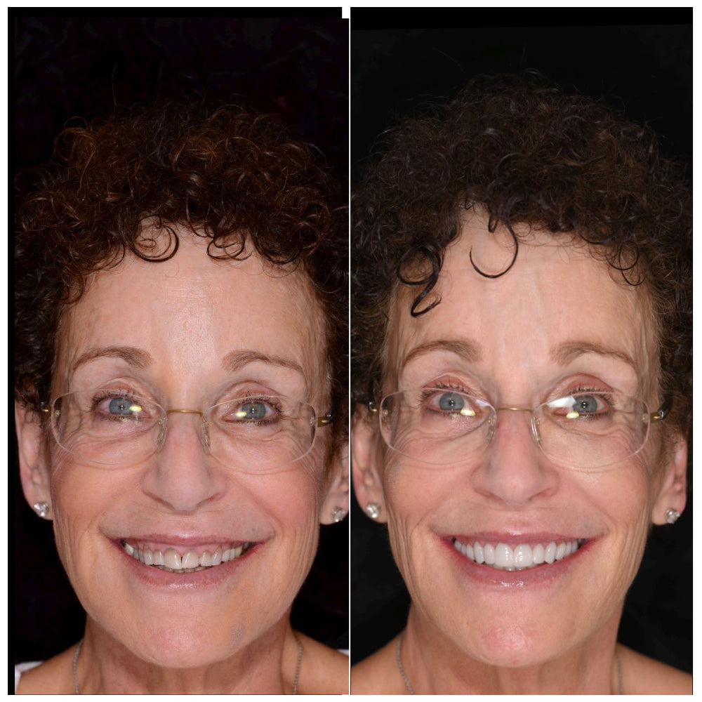 Before and after smile portrait photographed against the Stribe Portrait Background