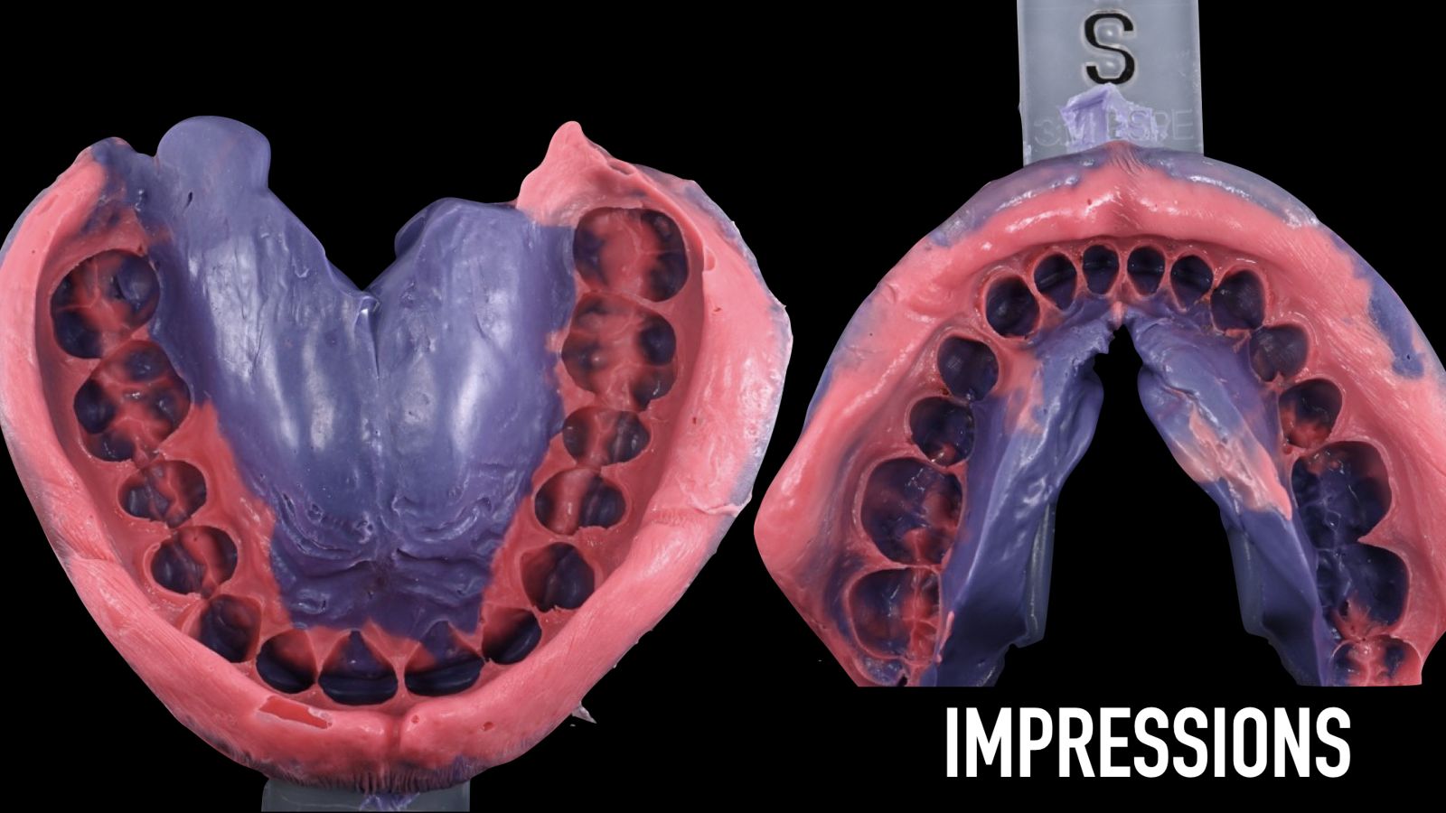 The Master Model: From Impression to Refractory Die