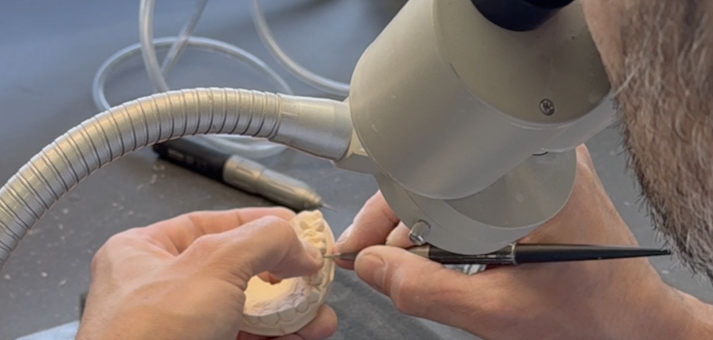The Master Model: From Impression to Refractory Die