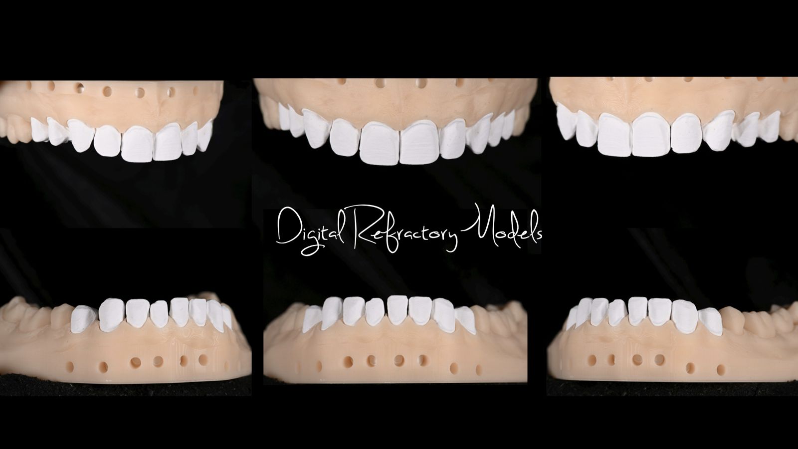 The Master Model: From Impression to Refractory Die